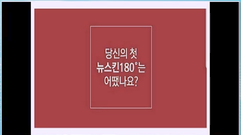 [5/16] TE 나예서 - 180도와 갈바닉