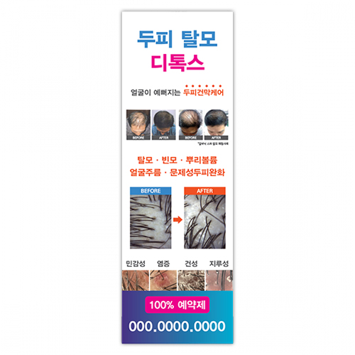 두피탈모 디톡스 엑스배너